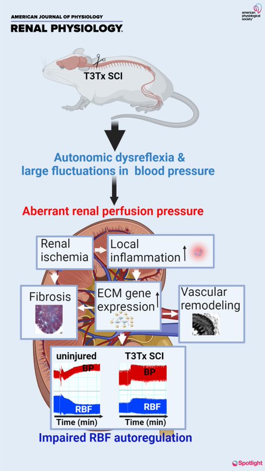 AJPRenal's tweet photo. New #SpotlightCover- Maladaptation of Renal Hemodynamics Contributes to #Kidney Dysfunction Resulting from Thoracic #SpinalCord Injury in Mice
Patrick Osei-Owusu*, et al.
🖱https://t.co/dkhpzI5aUz
#AJPRenal @poseiowusu @CWRUSOM @DrexelMedicine 
Cover Info: https://t.co/cM34ODfc8w https://t.co/r0piMrVvu1