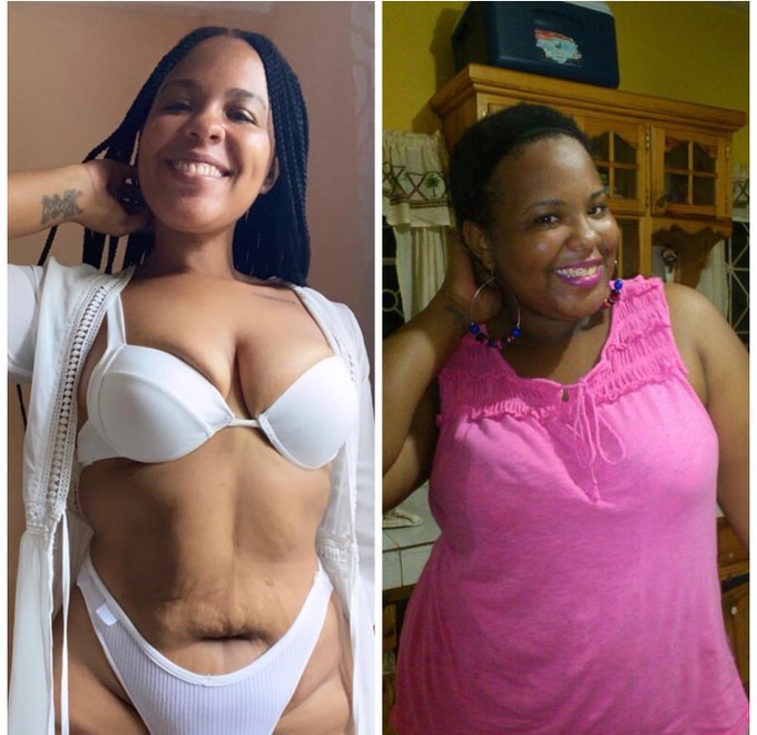 Lost over 100lbs of fat and can lift twice my body weight, but my double chin does not give a fuck #transformation<a href="/tag/transformation"class="tags"><span>#transformation</span></a>