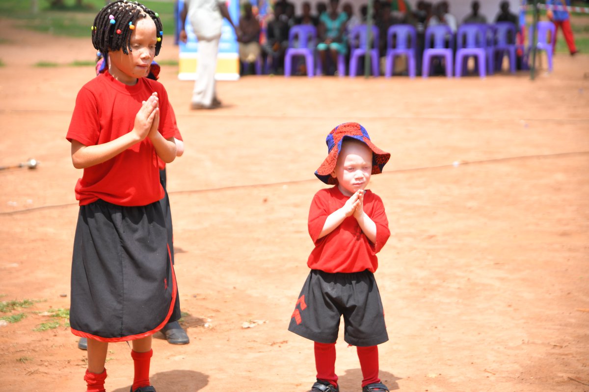 The physical appearance of people with #albinism is often the object of erroneous beliefs and myths influenced by superstition, which foster marginalization and even violent attacks against them. Include people with albinism &amp; treat them as equals.    #UnitedToMakeOurVoiceHeard