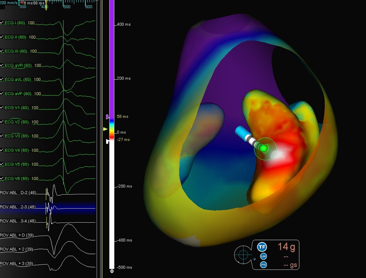 Adam Turcott tweet media
