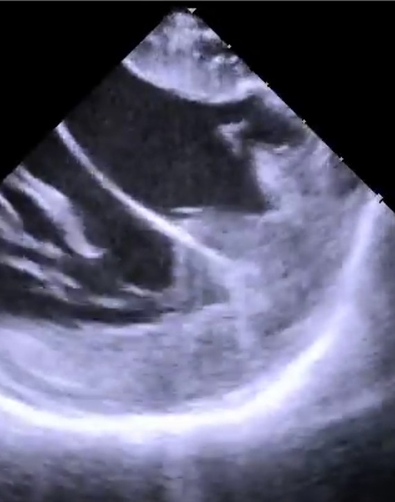 Adam Turcott tweet media