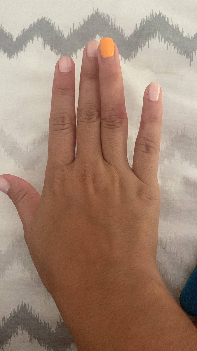 YakelinQuinter's tweet photo. Han pasado más de 24 horas y #amazon no se ha puesto en contacto conmigo de forma efectiva, solo me indican que debo rellenar formularios de #atencionalcliente @AmazonNewsES @amazon @AmazonHelp  así quedo mi dedo luego de la agresion por parte de un repartidor/  @fuenmayorernie https://t.co/kfOMGCQQW2