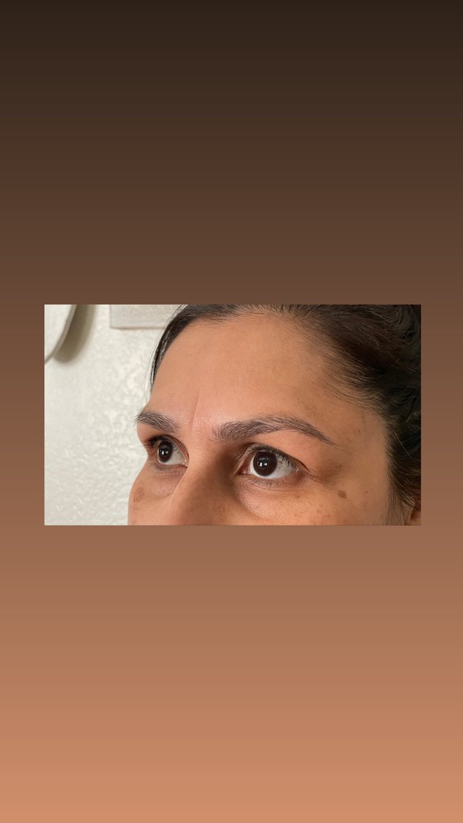 vicctorriaaaaa's tweet photo. Hey I’m looking for new clients! I’m in the LA County area, and this is my first clients healing progress after her first microblading procedure a month ago!😍 still practicing but pls feel free to dm me to book🤍 she still has her 10 week touch up coming soon!🥰 https://t.co/sSQQOHgS1V