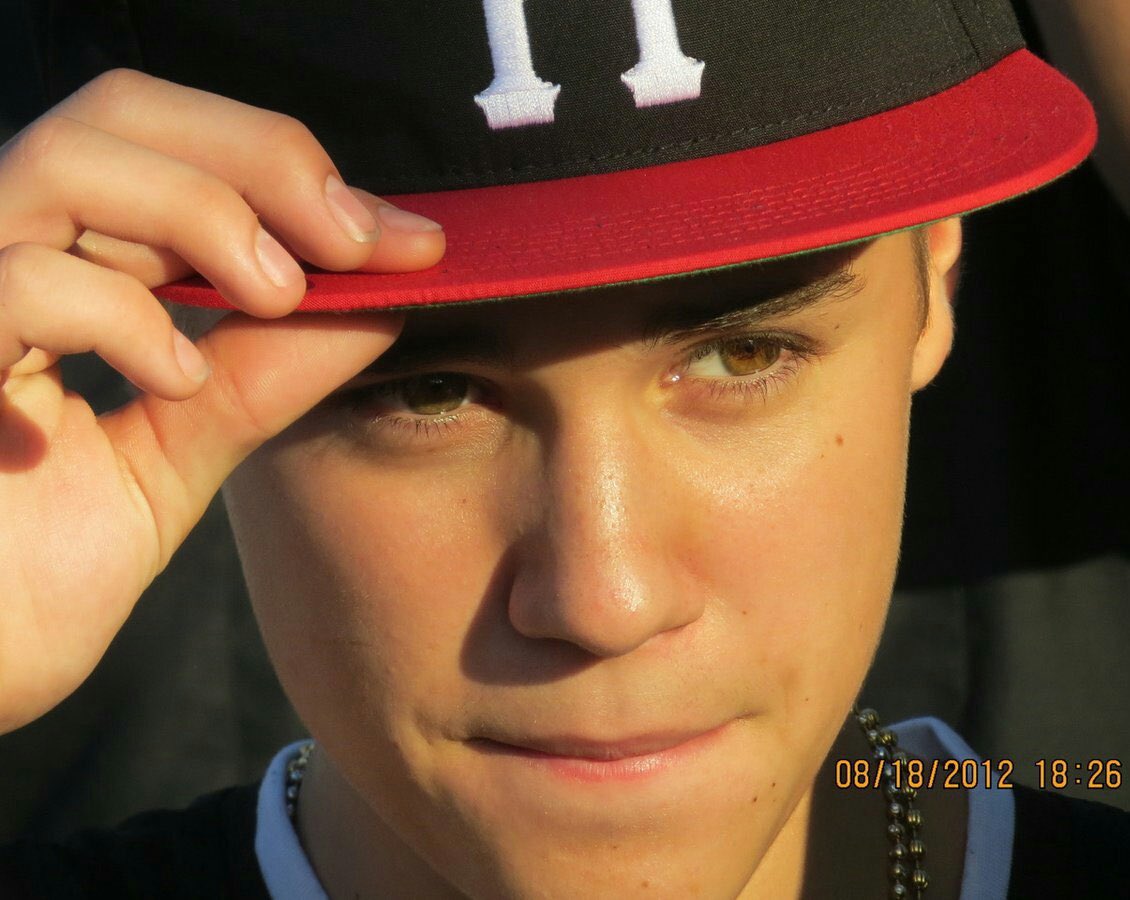 there is not a single flaw on his face