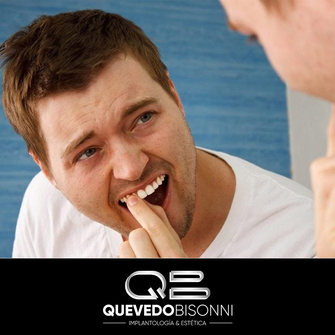 CQuevedoBisonni's tweet photo. ¡Buenos días Sonrisas! ¿Qué se desaconseja ante una situación de dientes flojos?
Los dientes flojos se pueden deber a un traumatismo leve. No se deben tocar con la lengua ni los dedos ni apretar los dientes.
.
.
#dientessanos #sonrisassanas https://t.co/jggSnW37Zk
