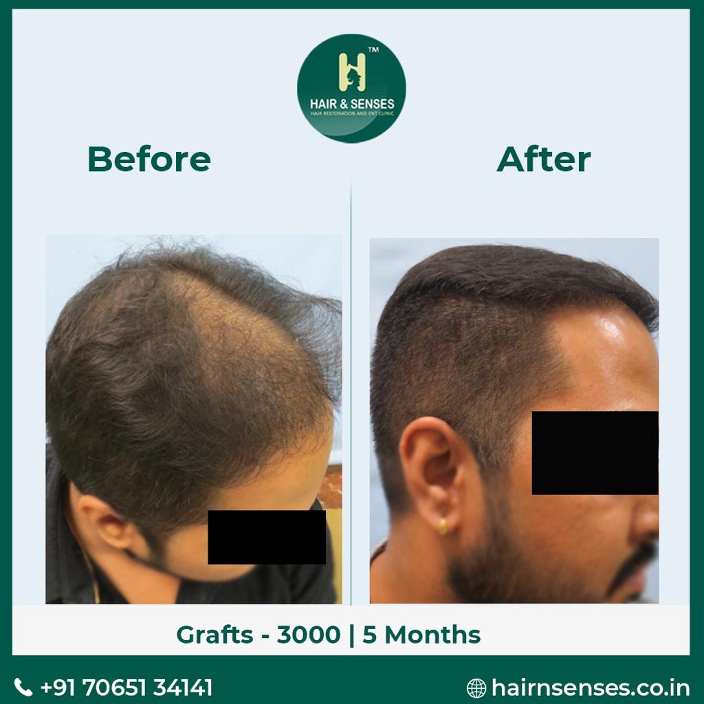 Hair & Senses on Twitter: Hair & Senses on Twitter:
