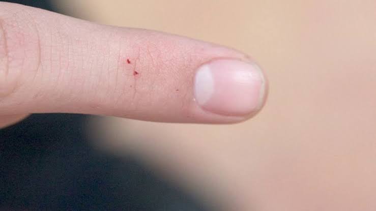 Cryptoverse0101's tweet photo. @jameslavish Snake bite, What matters is not the size, but the effect. https://t.co/ObPUPDLaxn