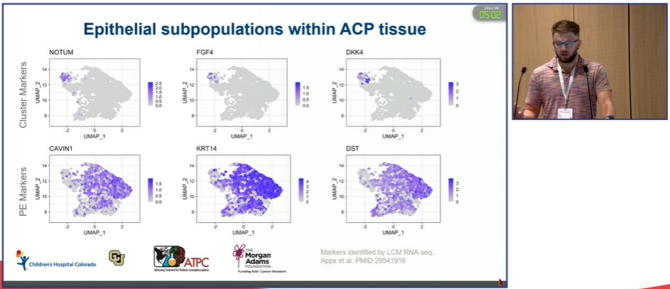 MorganAdamsFdn's tweet image. Eric Prince is presenting his craniopharyngioma single-cell analysis on the final day of #ISPNO2022, barely scratching the surface of this groundbreaking cell-level characterization of ACP