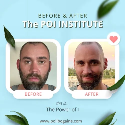 What a difference a week can make at The POI Institute.  Contact us to learn what we can do for you.  (833) POI-CABO  info@POIibogaine.com  #ibogainetherapy #addiction #recovery #poicabo