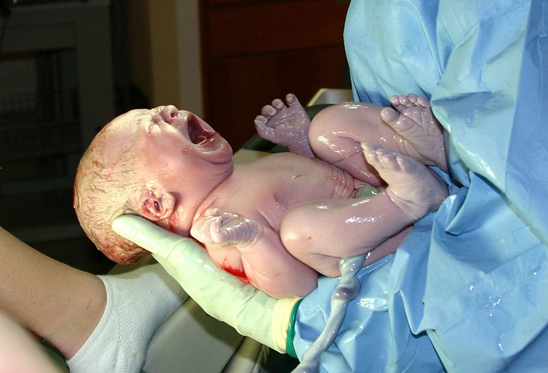GYerathel's tweet photo. medical student mistakenly cut a newborn's infant penis after thinking its the umbulical cord, worse the 
 surgeons attempted to hide it from the parents so they can attach it back https://t.co/2fbbzJqjzD
