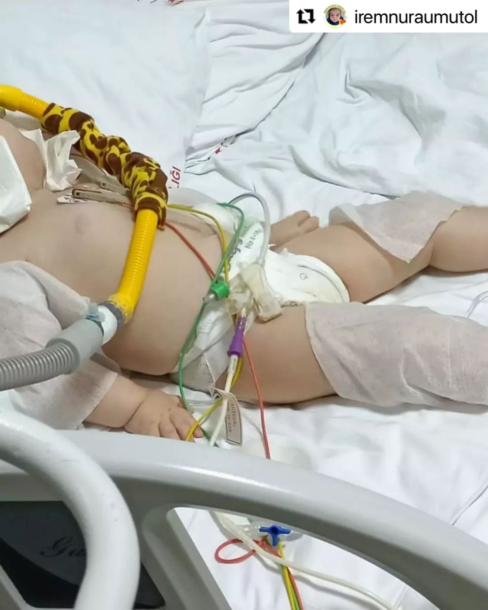 🔔 SON DURUM
NABIZ 215 ATEŞ 39°C-40°C
Yüksek enfeksiyon yüzünden spinrazayı alamadı…
Yine herhangi bir gönderi gibi bakıp geçecekmisiniz? Geçmemelisiniz!
Lütfen artık bu duruma seyirci kalmayın!
#motorin #Tarkan Squid Game #CanYaman #bitcoins #istifa #Ethereum Ayın 15 #İstanbul