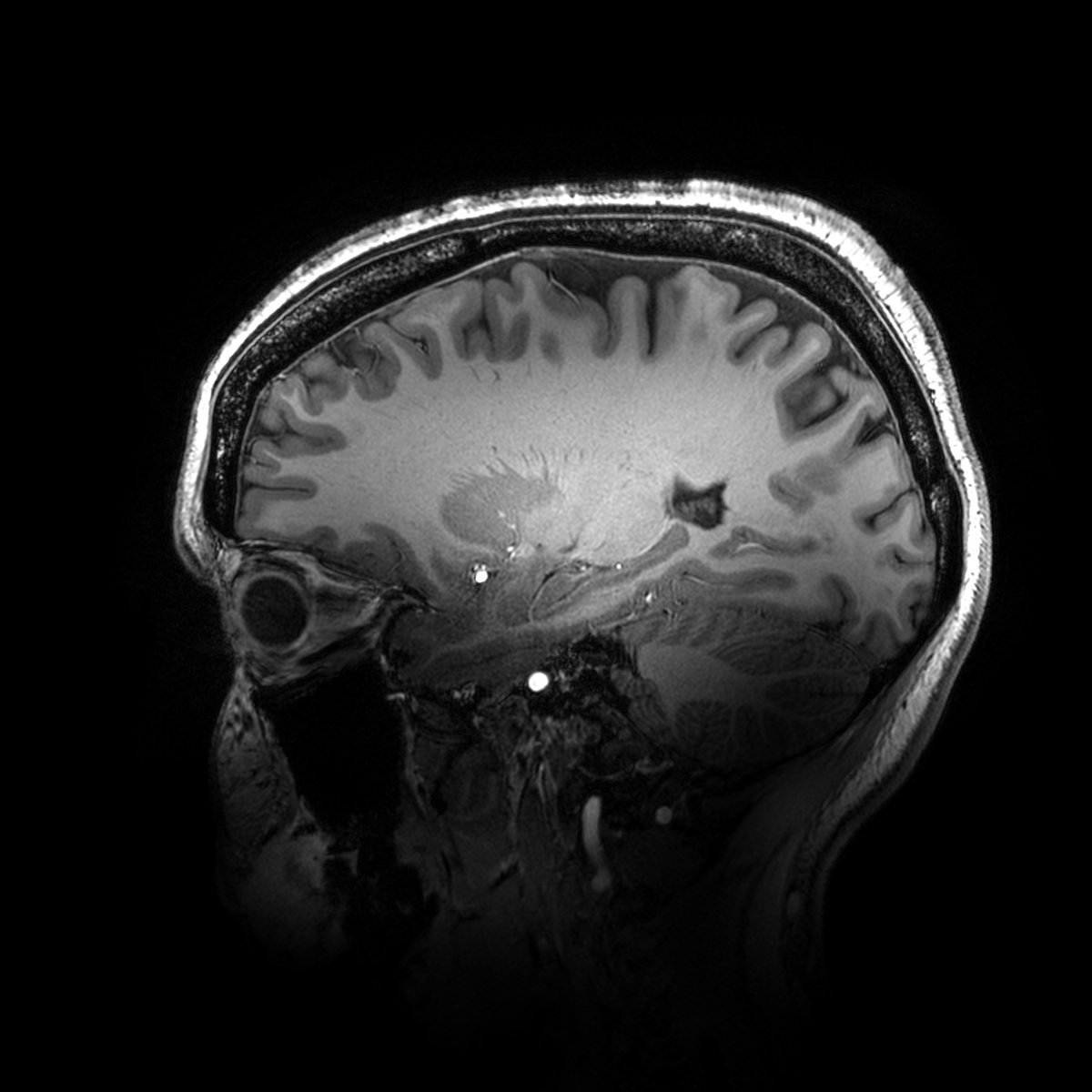 Largest ever funding award of £29.1 million to establish the UK’s most powerful #MRI scanner as a national facility <a href="/SPMIC_UoN/">SPMIC</a> to give unprecedented insights into brain function and the mechanisms of human disease <a href="/UoN_Physics/">UoN Physics & Astronomy</a> <a href="/UoNresearch/">Nottingham Research</a> <a href="/UKRI_News/">UK Research and Innovation</a> 

tinyurl.com/4zbu2cs7