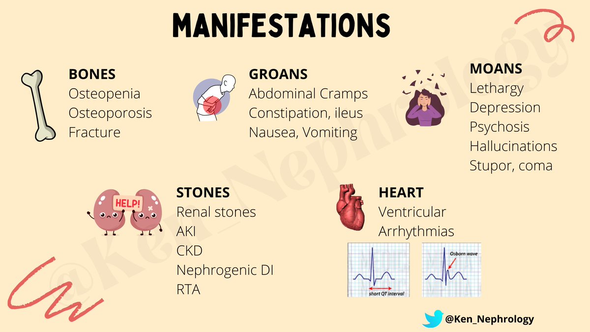 Ken_Nephrology's tweet photo. #KenMakesNephrologyEasy
#KenEasyNotes
#KENSeries

🦴 Hypercalcemia https://t.co/m1QeFF5T9J