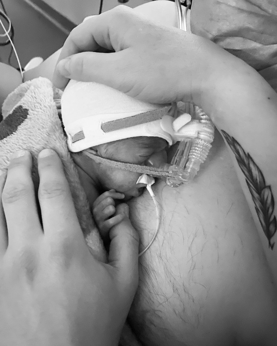 tutiflea's tweet photo. 10 jours de vie poids de naissance récupéré 🌈 #prema #29sa https://t.co/C7XsLbmWDC
