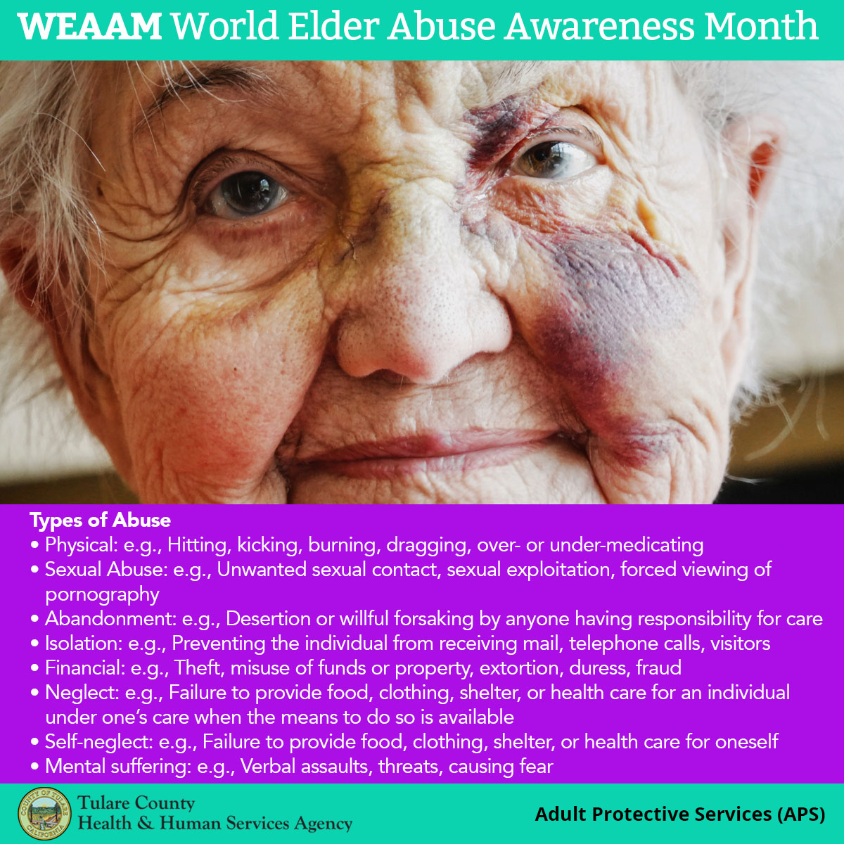 TulareCo_HHSA's tweet photo. Today is World Elder Abuse Awareness Day
Elder abuse is happening, but we can bring awareness. If you or a loved one is experiencing abuse please call (559) 623-0651 or (877) 657-3092.
Know the signs. To learn more visit: https://t.co/tzClHzK04E
#WEAAM #TCHHSA https://t.co/ciIohSylv7