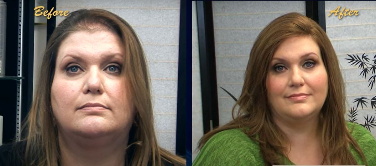 MicroStrand's tweet image. Micro Strand - The Revolutionary Breakthrough provides Exclusive Advanced Benefits.
Keeping your own hair HEALTHY, and stimulating your hair growth too!
Hear what customers say about us!
Learn more here
invisablend.com/advanced-benef…

#scalppigmentation #femalehairloss #baldmen #beauty