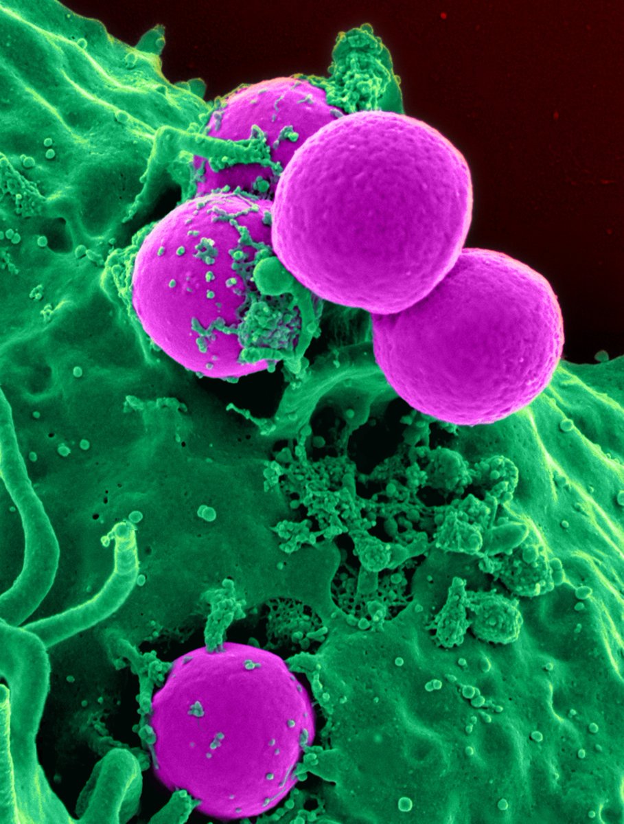 IdylleLabs's tweet photo. Modulating matrix stiffness w/ sugar threose to understand tumor invasion: a #ResearchTool to answer the question of the importance of tissue rigidity in the chronology of tumor invasion

Shared by Marie Tautou🙏🙏🙏

🫴 https://t.co/z2aMBAIq8X
#CellTransformation #cancerresearch https://t.co/7PgY8707Fy