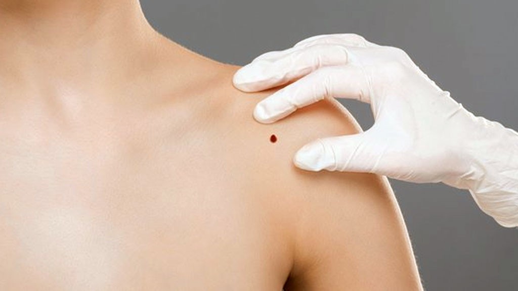 portusaludcsr's tweet photo. #SALUD | ¿Cómo debemos proteger la piel? Hablamos de ella, del sol y de la prevención del melanoma con la colaboración de Gloria Garnacho @HUReinaSofia y @draMorenoSuarez @HospitalJaen @aedv_es, en @CanalSurRadio @ejmc60
▶️ https://t.co/hI061LMHv2 https://t.co/UeDPlBW4Ik