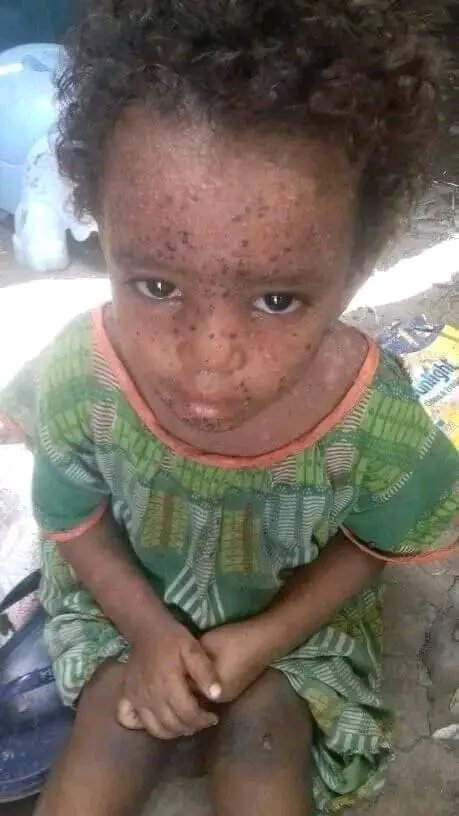 Wedi_AbayT's tweet photo. #IC u need to #weak_up💔
🇪🇹an gov't detained abt >1200 innocent #Tigray ppl in #sheket[Afar]concentration https://t.co/QDiBwZVWlY a result many of children r getting #sick
#Tigray ppl highly demand ur #help,#support n #justice
#EndTigraySiege
@hrw @SecBlinken @WHO @IntlCrimCourt https://t.co/P0AVxEeNm1