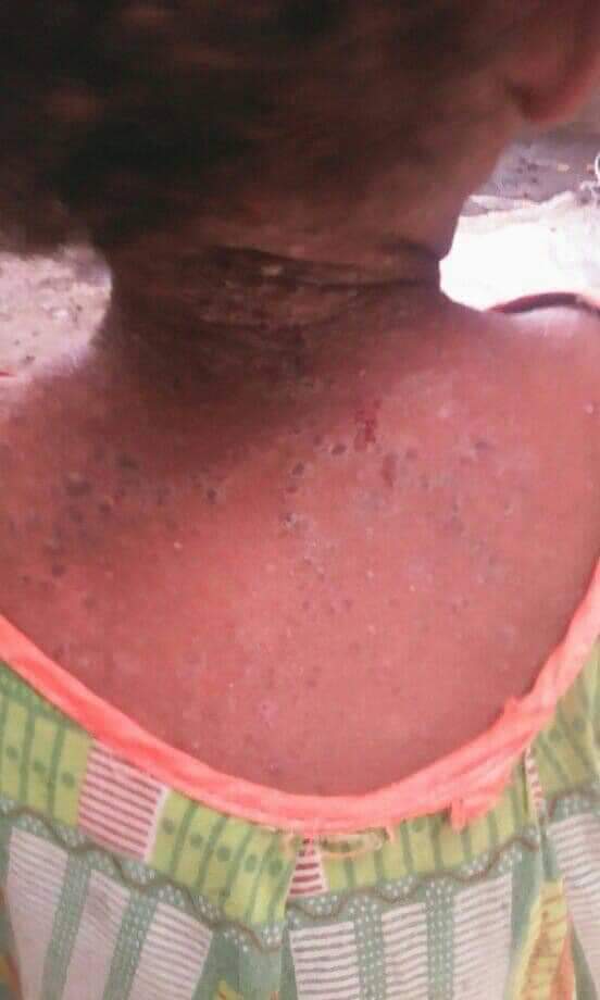 Ofisen1's tweet photo. More than 12,000 #Tigrayans, including children abducted from #Sheket to #Afar #Semera, are dying of various diseases and famines.🚨
#ChildrenOfTigray
#TigrayEthnicCleansing
@UNICEF @GermanyDiplo @EU_Commission @UNOCHA @SecBlinken @EUCouncil @UNGeneva @StateDept @amnesty https://t.co/qTkjtJMea8