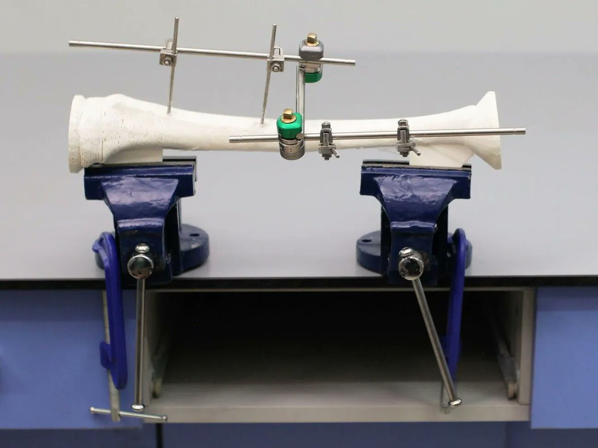 In conflict zones, 25% of injuries are gunshot-related fractures. #GlobalSurgicalChallenge finalist Tibial Fracture Fixation has designed a simulation trainer to teach non-orthopaedic medics how to treat these injuries. Meet the team here: buff.ly/3zztRrn