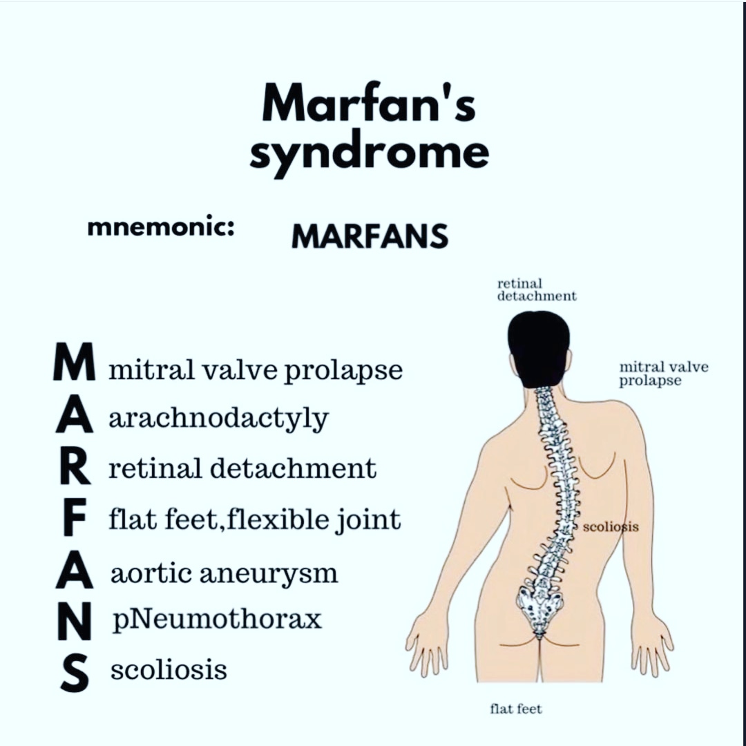 #marfansyndrome 
#medicine #pathology  #medicos #medicalschool  #futuredoctor #nurselife #nursing #mbbs #doctor #pharma #neet #medico #nursingschool #pharmacology  #nurses #meditation #medical #medicalstudent #Mediterranean #trendingnow #trend #trending #treatment #treatyourself