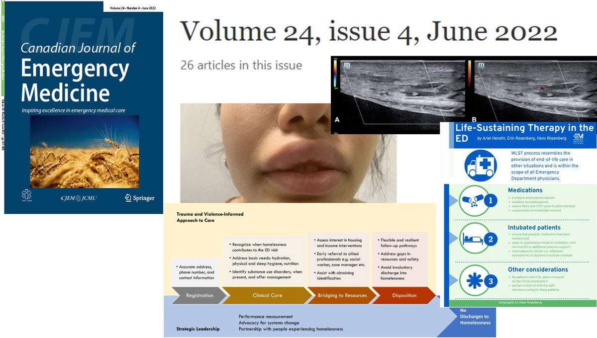 ClinMedJournals's tweet photo. #CJEM
The June 2022 issue is online! https://t.co/PGyGjQm740
Featured articles:
▶️#trauma
▶️#SDG
▶️#COVID19
▶️#allergy
▶️#Life_support
▶️#Doppler & #paracentesis
▶️#Cardiac_arrest
and more..
@CJEMonline @CAEP_Docs @CAEPResidents @EMO_Daddy @EddyLang1 @PaulAtkinsonEM @IFEM2 https://t.co/cXrAs7YPc8