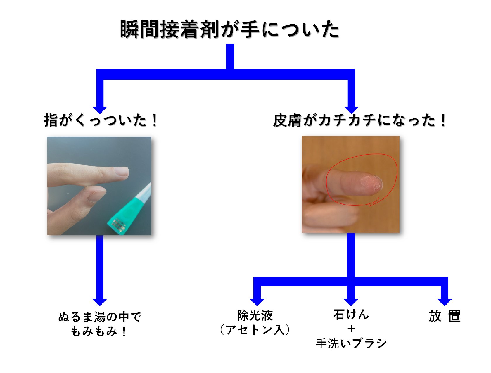 瞬間 接着 剤 手 につい た