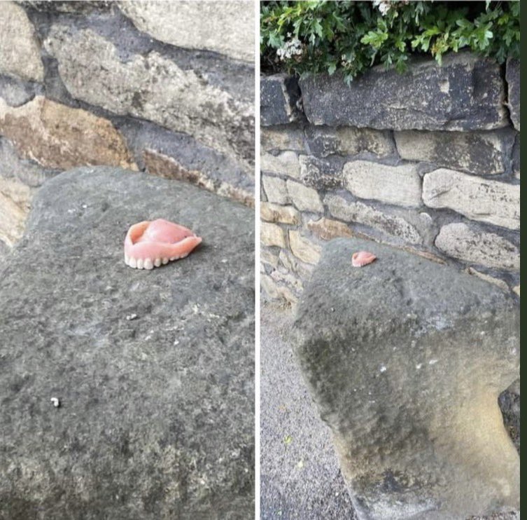 Yine bir protez uzmanının kalbi kırılmış…