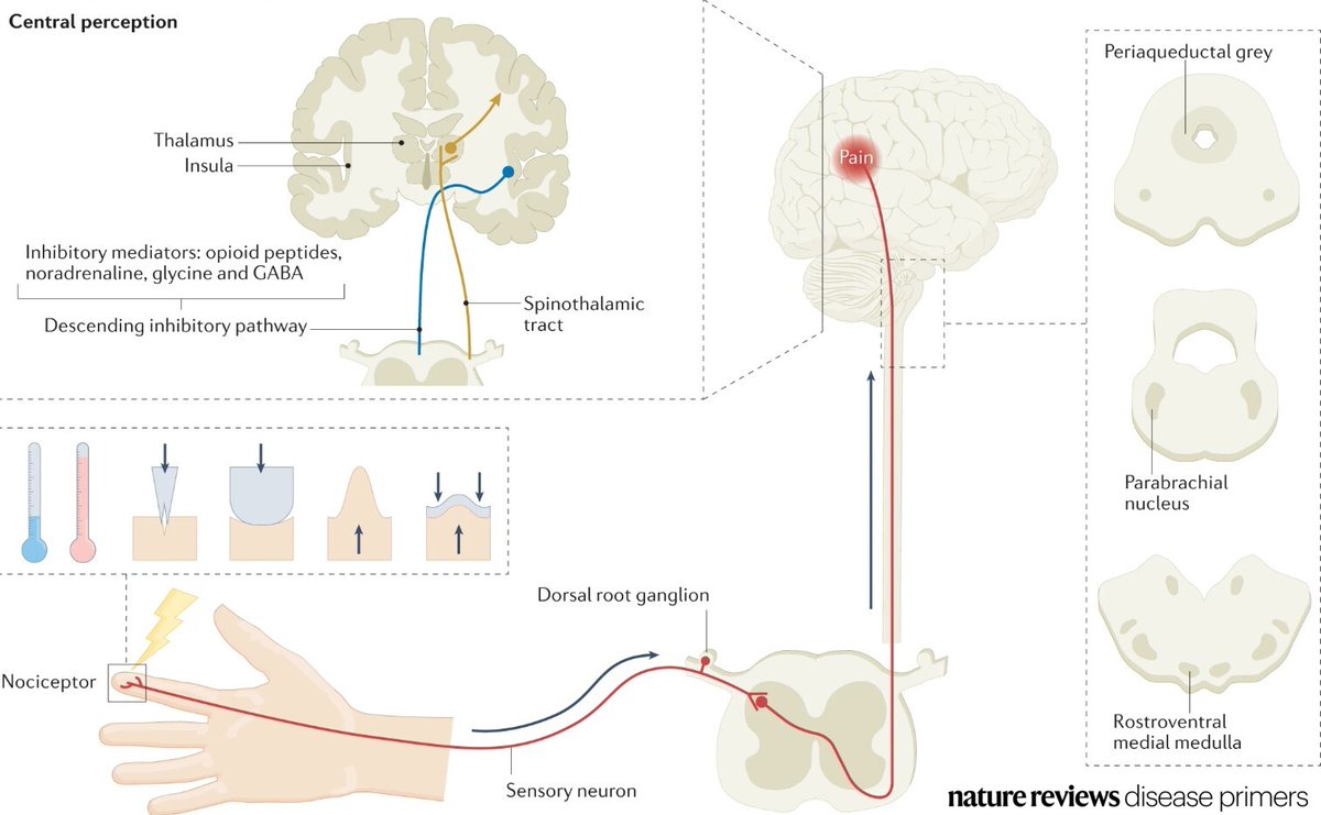 #Pain is mediated by subtypes of sensory neurons that project to the spinal cord and, subsequently, the brainstem and brain.

go.nature.com/3tF6Z63