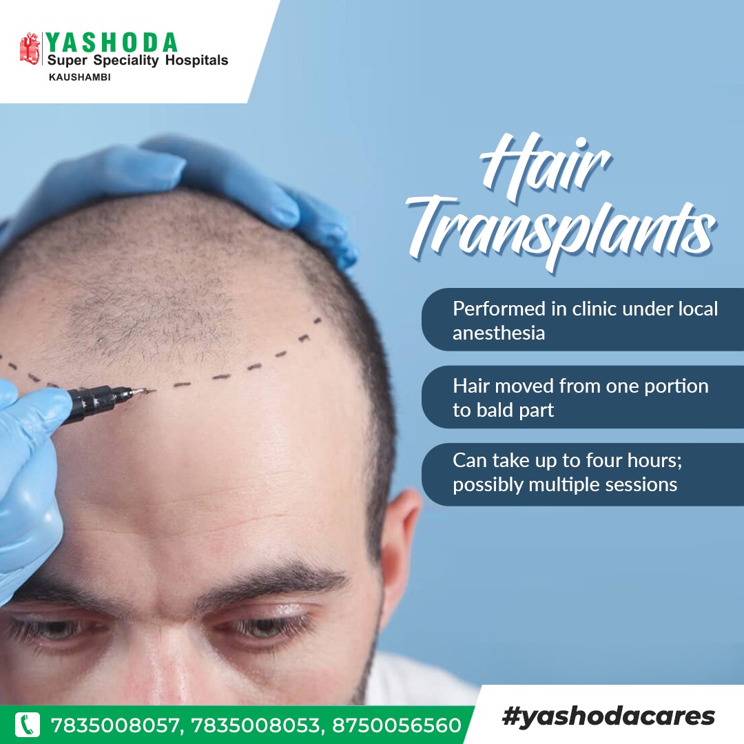 Yashoda Super Speciality Hospitals on Twitter: Yashoda Super Speciality Hospitals on Twitter: