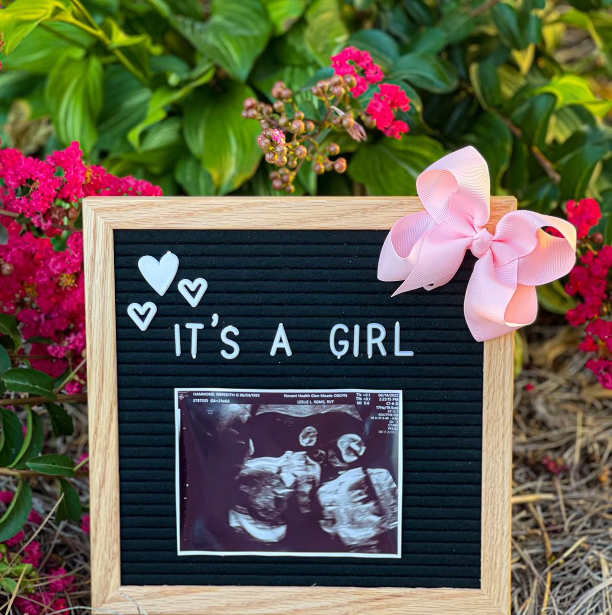 MeredithGore1's tweet photo. SURPRISE… baby Hammond is a GIRL!! It looks like baby girl is already keeping us on our toes lol.Looks like we are going to be girl parents and we are so excited! I can’t wait to see Fielding as a girl dad 🥹💕🎀 bring on all the pink, bows and ruffles! 💕🎀@fletch0283 https://t.co/OmyV8Z3zZE