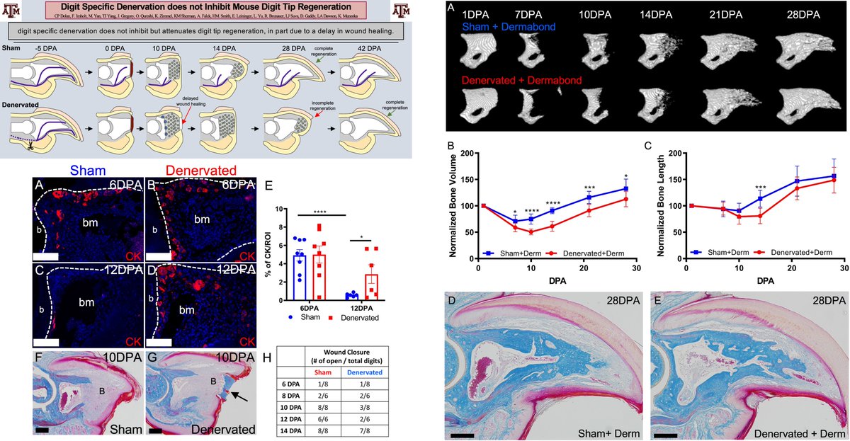Dev_Bio_Journal's tweet photo. #DBfeature #DigitRegeneration #Blastema
Digit-specific denervation does not inhibit mouse digit tip regeneration
by Connor Dolan et al
"...locally removing innervation to the digit tip without influencing mechanical loading to the limb..."
https://t.co/A2MzukgCjL https://t.co/gZl0zrnX2Q