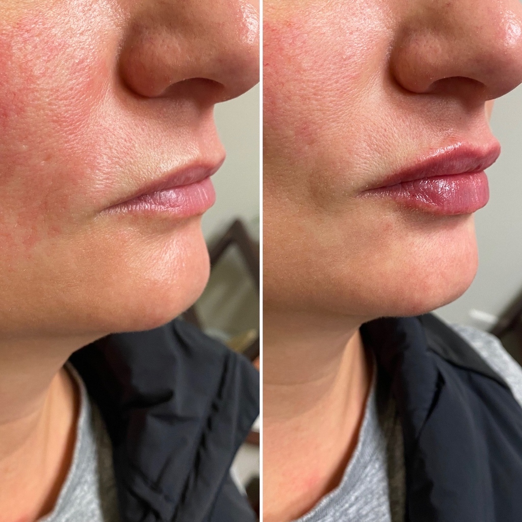 Nayak Plastic Surgery & Avani Derm Spa tweet media