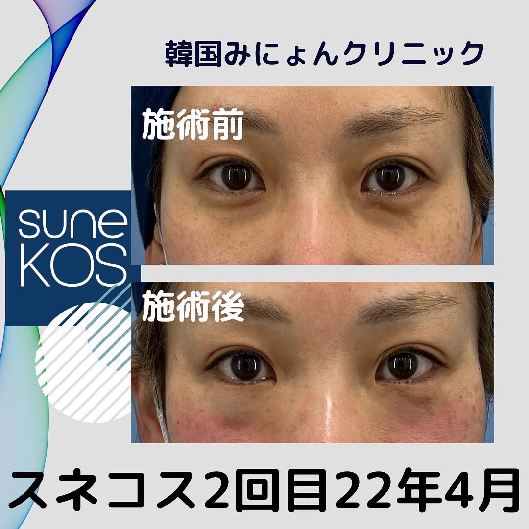 クマ治療 Twitter Search Twitter