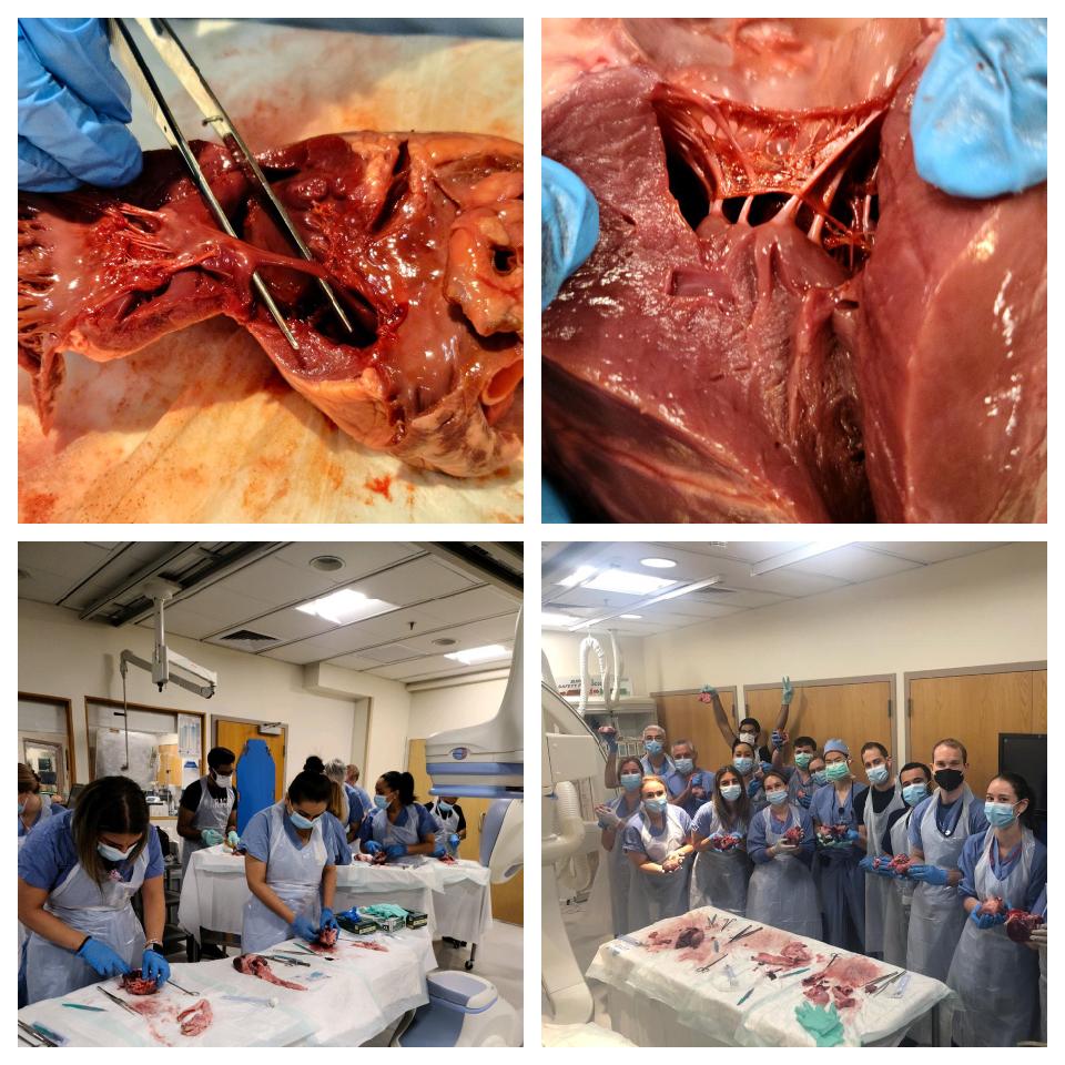 Annual Tufts Cath Lab Heart Dissection day. A wonderful exercise in re-learning anatomy, correlation with echo imaging and team-building.