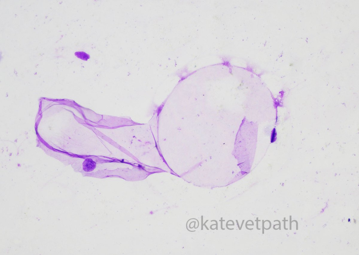 Adipocytes from an impression smear of a lipoma. #vetpath #vetcytology
