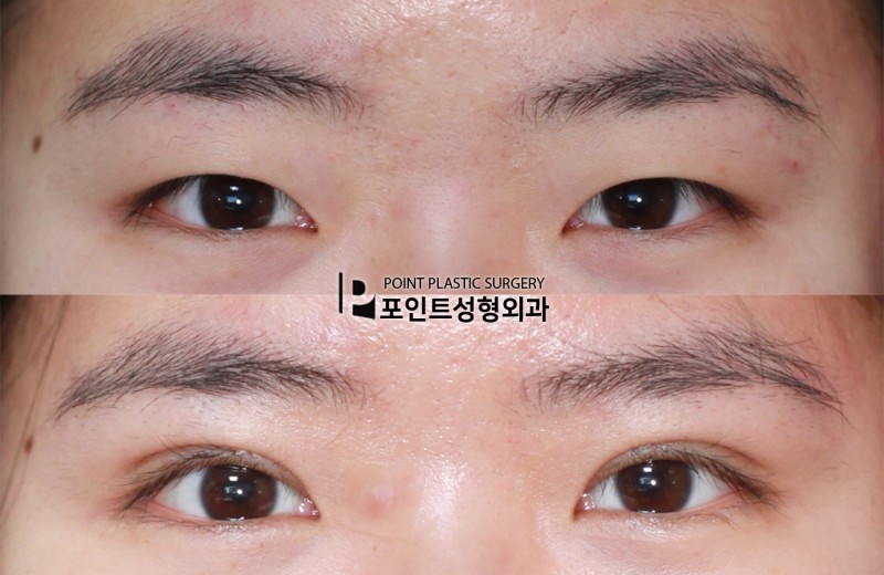 ポイント整形外科 Pointpsjp Twitter