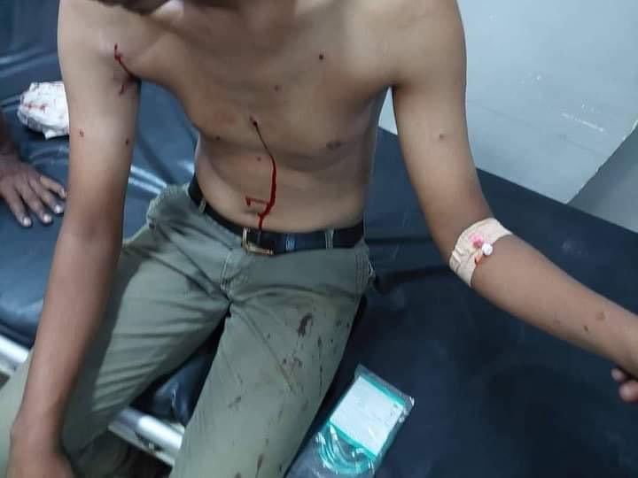Nmhali's tweet photo. #June16March
#SudanCoup forces shot at protesters. Many sustained gunshot wounds, mostly the notorious buckshot.
Some injuries are in vital organs.
#Sudanese #Sudan
#KeepEyesOnSudan https://t.co/R3U4QL2cAu