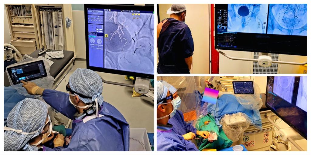 CIRSE (@cirsesociety) on Twitter photo #Day4 #CIRSEtakeover #faroukTradi Highlight on hemorrhoid embolization <a href="/aphm_actu/">AP-HM - Hôpitaux Universitaires de Marseille</a> <a href="/prvinvidal/">Vincent Vidal</a> <a href="/Fairembo13/">FairEmbo 🍀 Pr VIDAL</a>. Today receiving a 50 yo patient w/ anemia related to chronic hemorrhoid bleeding referred by surgeon @DrMege. Patient leaving the angio suite on foot #Emborrhoid #WomeninIR #Day4 #CIRSEtakeover #faroukTradi Highlight on hemorrhoid embolization <a href="/aphm_actu/">AP-HM - Hôpitaux Universitaires de Marseille</a> <a href="/prvinvidal/">Vincent Vidal</a> <a href="/Fairembo13/">FairEmbo 🍀 Pr VIDAL</a>. Today receiving a 50 yo patient w/ anemia related to chronic hemorrhoid bleeding referred by surgeon @DrMege. Patient leaving the angio suite on foot #Emborrhoid #WomeninIR