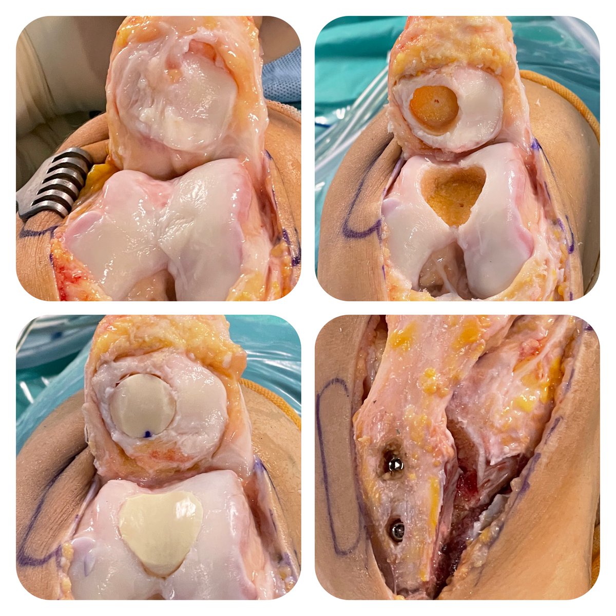 Dr. Pablo Gelber tweet media