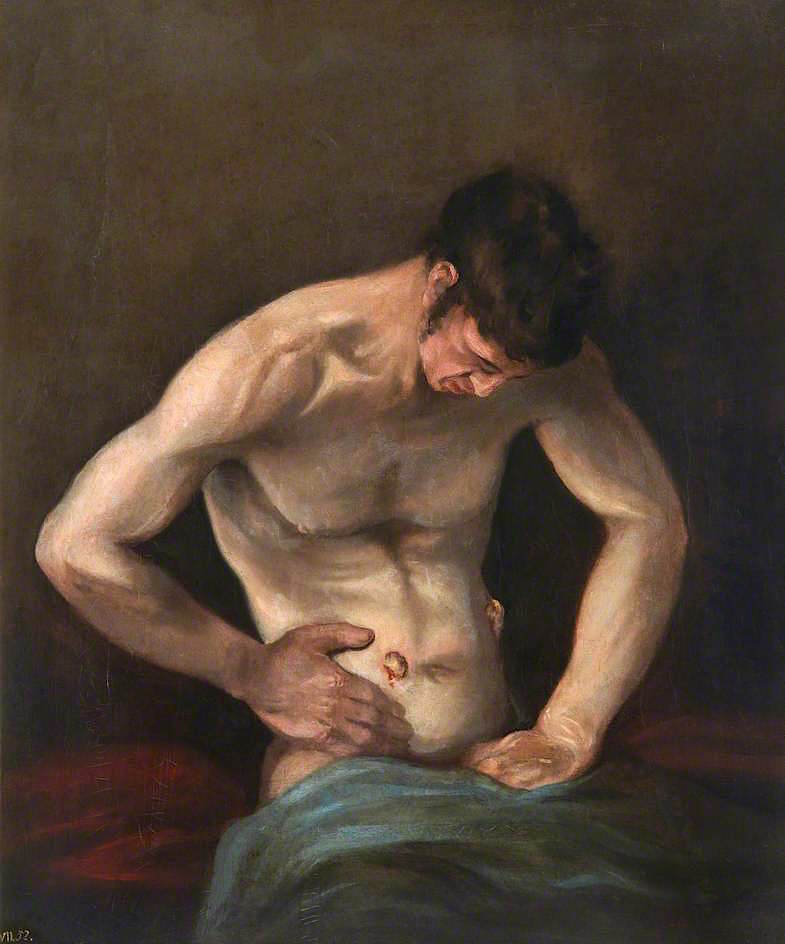 Michael Brown (@medhistoryman) on Twitter photo Apparently my article on war, emotion, and Romantic surgery was a #TopDownloadedArticle in <a href="/JECSjournal/">Journal for Eighteenth-Century Studies</a> during the first year of publication. That'll be because it is Open Access of course, but it also means that I get to plug it again! Check it out here:
bit.ly/3b5ll9j Apparently my article on war, emotion, and Romantic surgery was a #TopDownloadedArticle in <a href="/JECSjournal/">Journal for Eighteenth-Century Studies</a> during the first year of publication. That'll be because it is Open Access of course, but it also means that I get to plug it again! Check it out here:
bit.ly/3b5ll9j
