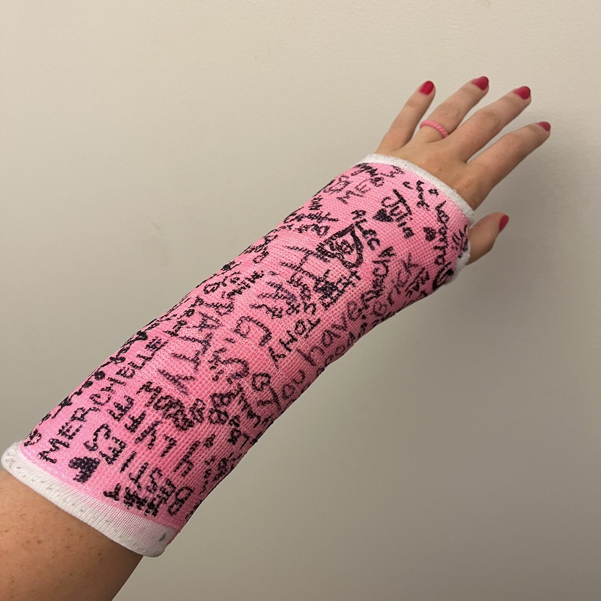 jadesnorwood's tweet photo. POV: you break your wrist the week of the agency summer party https://t.co/GBA6uODJp9