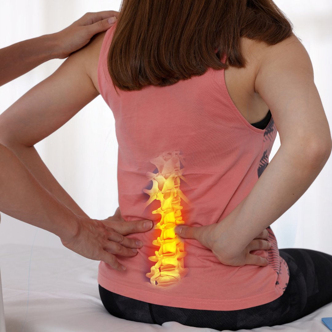 IHSP_SCC's tweet photo. Another study recently concluded that spinal manipulation (what’s provided in our clinic) is an effective treatment for lumbar disc problems. Give our office a call today to see how chiropractic care can help! 

#backpain #lumbardisc #chiropractic https://t.co/txthzaPzar