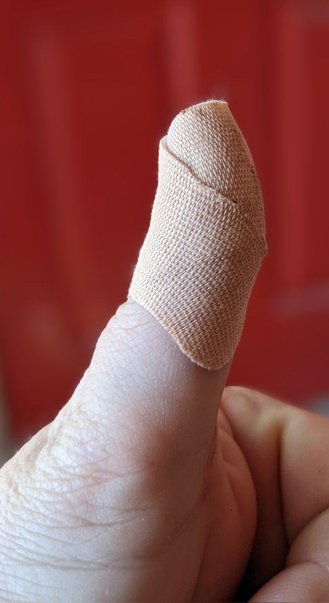 AnnaLogue75's tweet photo. In part 2 of our educational series "What NOT to do to yourself in the kitchen" we will inform about the dire need of avoiding cutting your thumb open with a serrated knife while preparing for example apple slices. Please don't do it. It hurts.
#TestedAndTrue #Knifemare #Ouch https://t.co/9oCIeLjB7x