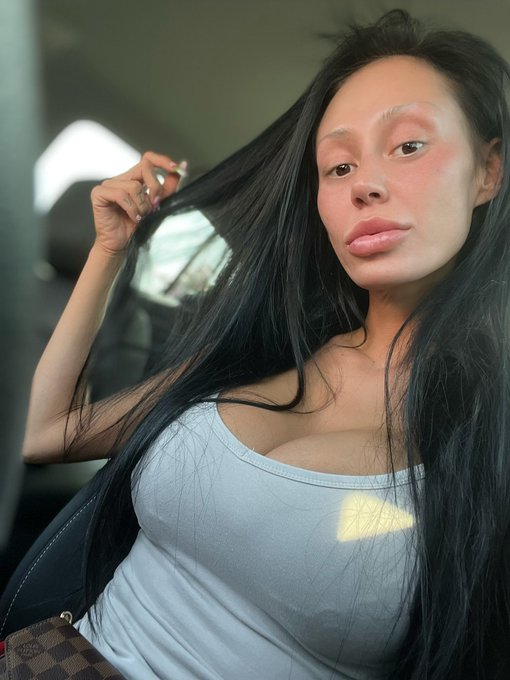 Really enjoying not putting on any makeup while my face heals from a chemical peel. How long do you wait<a href="/tag/nomakeup"class="tags"><span>#nomakeup</span></a><a href="/tag/fetish"class="tags"><span>#fetish</span></a><a href="/tag/enhansedbeauty"class="tags"><span>#enhansedbeauty</span></a>