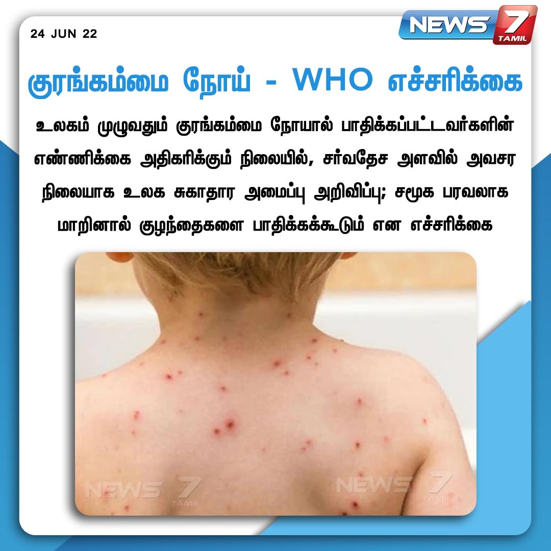 news7tamil's tweet image. #NEWSUPDATE 

குரங்கம்மை நோய் - WHO எச்சரிக்கை 

news7tamil.live | #MonkeyFever | #WHO | #News7tamil| #News7tamilupdates