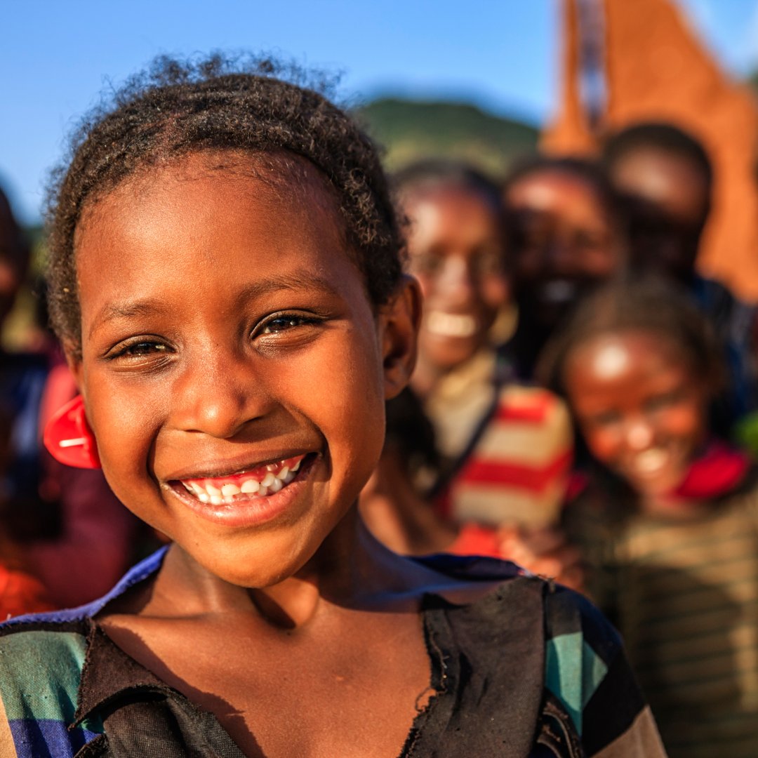 sciencesnco's tweet photo. [👩🔬SCIENCES&amp;... CHERCHEURS]
L'ulcère de Buruli est une maladie de peau que l'on retrouve surtout en Afrique. Elle touche en majorité les enfants, qui se contaminent au contact de l'eau. Elle provoque de grandes ulcérations cutanées, et peut toucher toute une partie du corps. https://t.co/PGvX6EUnBV