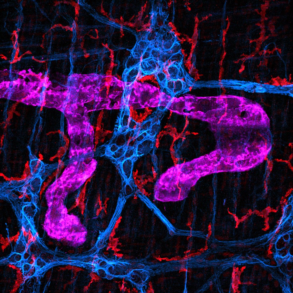 Integrated Neurogenic Mechanisms Laboratory (@inmlab) on Twitter photo Meet the “Gut’s Cleaning Crew” 🧹. Macrophages (red) mop up cellular waste and debris while lymphatic pipes (magenta) drain the waste away. #FluorescenceFriday <a href="/MIPS_Australia/">Monash Institute of Pharmaceutical Sciences</a> <a href="/INMLAB/">Integrated Neurogenic Mechanisms Laboratory</a> Meet the “Gut’s Cleaning Crew” 🧹. Macrophages (red) mop up cellular waste and debris while lymphatic pipes (magenta) drain the waste away. #FluorescenceFriday <a href="/MIPS_Australia/">Monash Institute of Pharmaceutical Sciences</a> <a href="/INMLAB/">Integrated Neurogenic Mechanisms Laboratory</a>