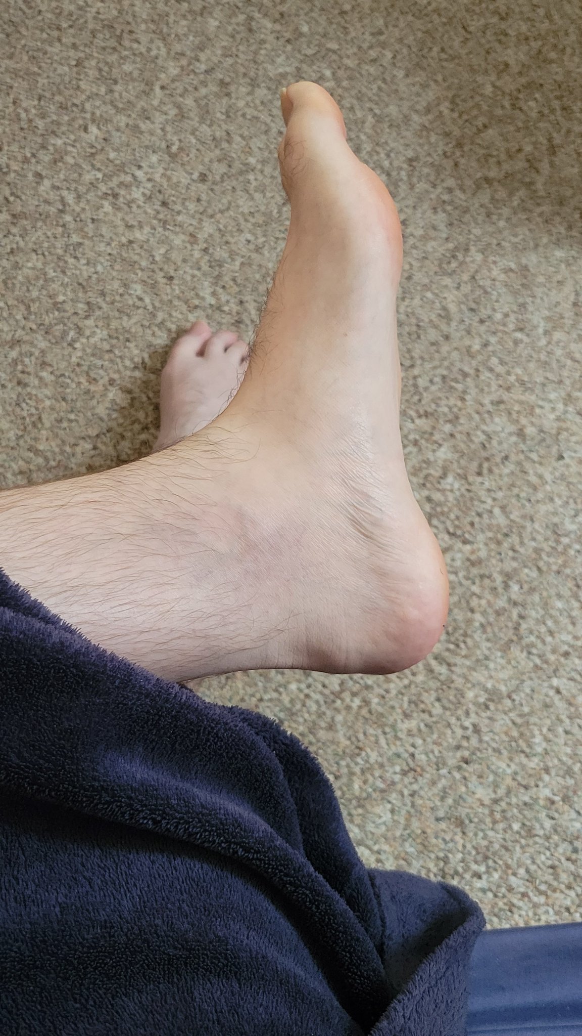 1 pic. Feet size 13W

#feet #manfeet #gayfeet #footfet?sh https://t.co/q6TBlMBa1D